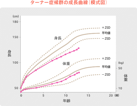 ターナー症候群の成長曲線（模式図）