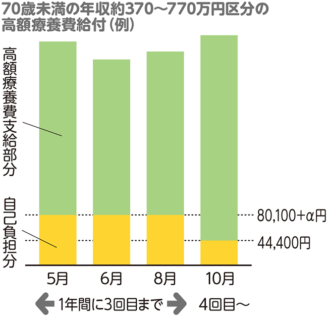 70歳未満の一般所得者の高額療養費給付（例）